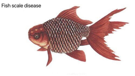 Fish scale disease